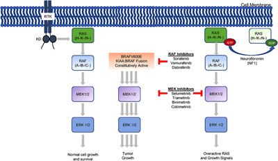 Neurosurgery for Optic Pathway Glioma: Optimizing Multidisciplinary Management